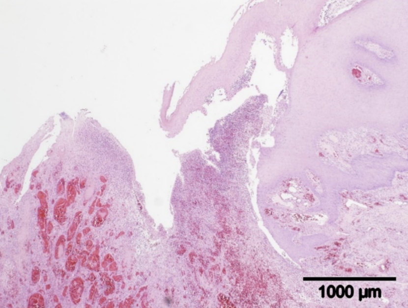Microscope slide with pink stained tissue